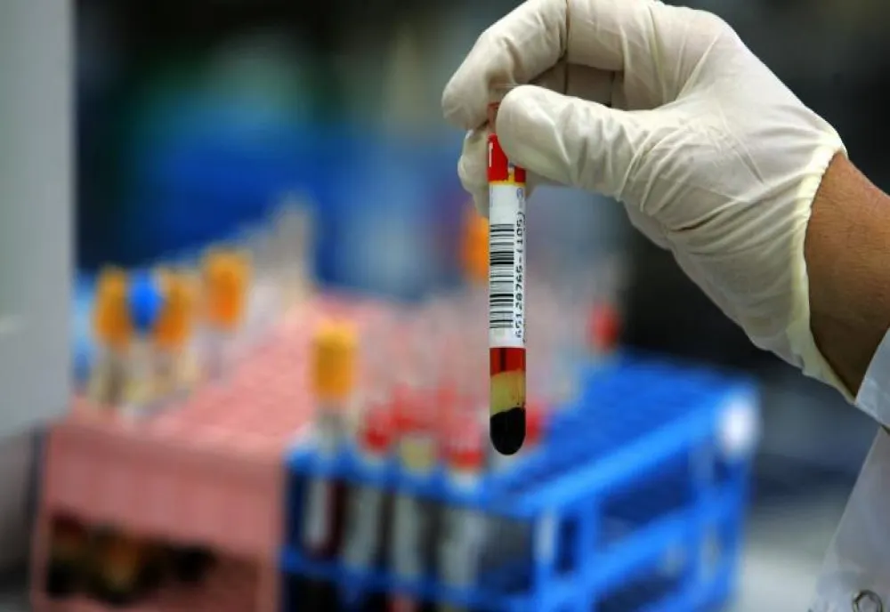 Cancerul mamar ar putea fi depistat cu un simplu test de sânge, cu cinci ani înaintea primelor simptome!