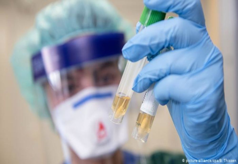 NE APROPIEM DE SCENARIUL 4: În România, sunt confirmate 1.452 de cazuri de persoane infectate cu virusul COVID19