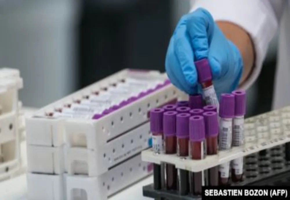 Prahova a depășit 500 de infectări cu coronavirus!