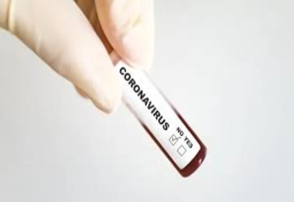 COVID-19: 823 de cazuri noi la 8.045 de teste. Cazurile noi, pe județe