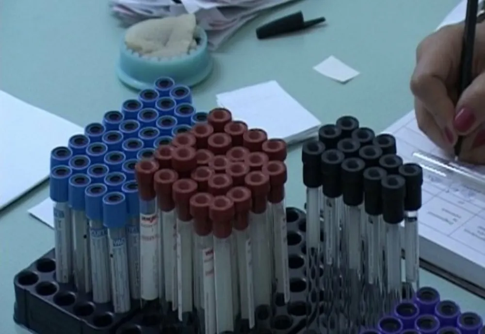 Persoanele peste 40 de ani pot beneficia mai ușor de investigații paraclinice fără plată