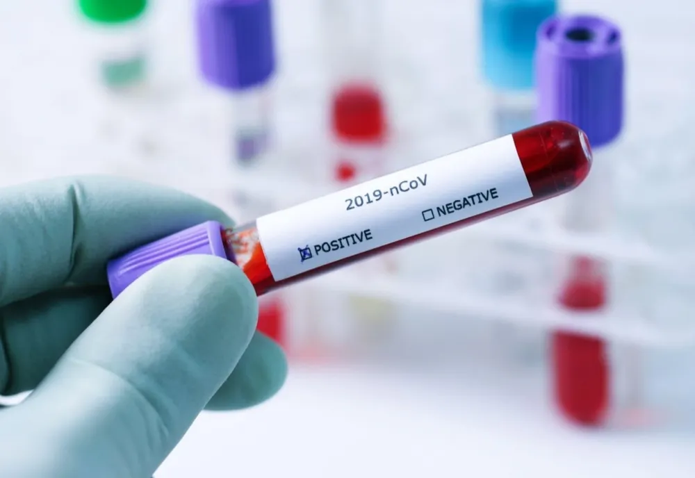 Bilanț coronavirus 7 august: 255 cazuri noi, 8 decese