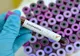Coronavirus: Al patrulea deces în Prahova
