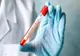 Un nou caz de coronavirus a fost confirmat în Prahova