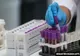 Prahova a depășit 500 de infectări cu coronavirus!