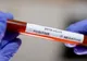Un polițist din Prahova a fost depistat cu coronavirus