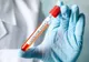 Focar de coronavirus la Primăria Câmpina