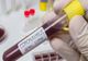 CORONAVIRUS: Au fost înregistrate alte 351 de noi cazuri de îmbolnăvire